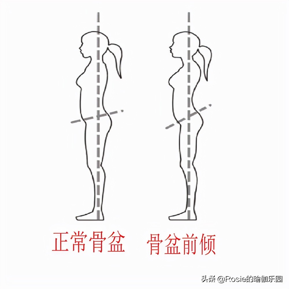 小腿外翻怎么瘦腿变成直腿,如何改善大腿外翻小腿外翻