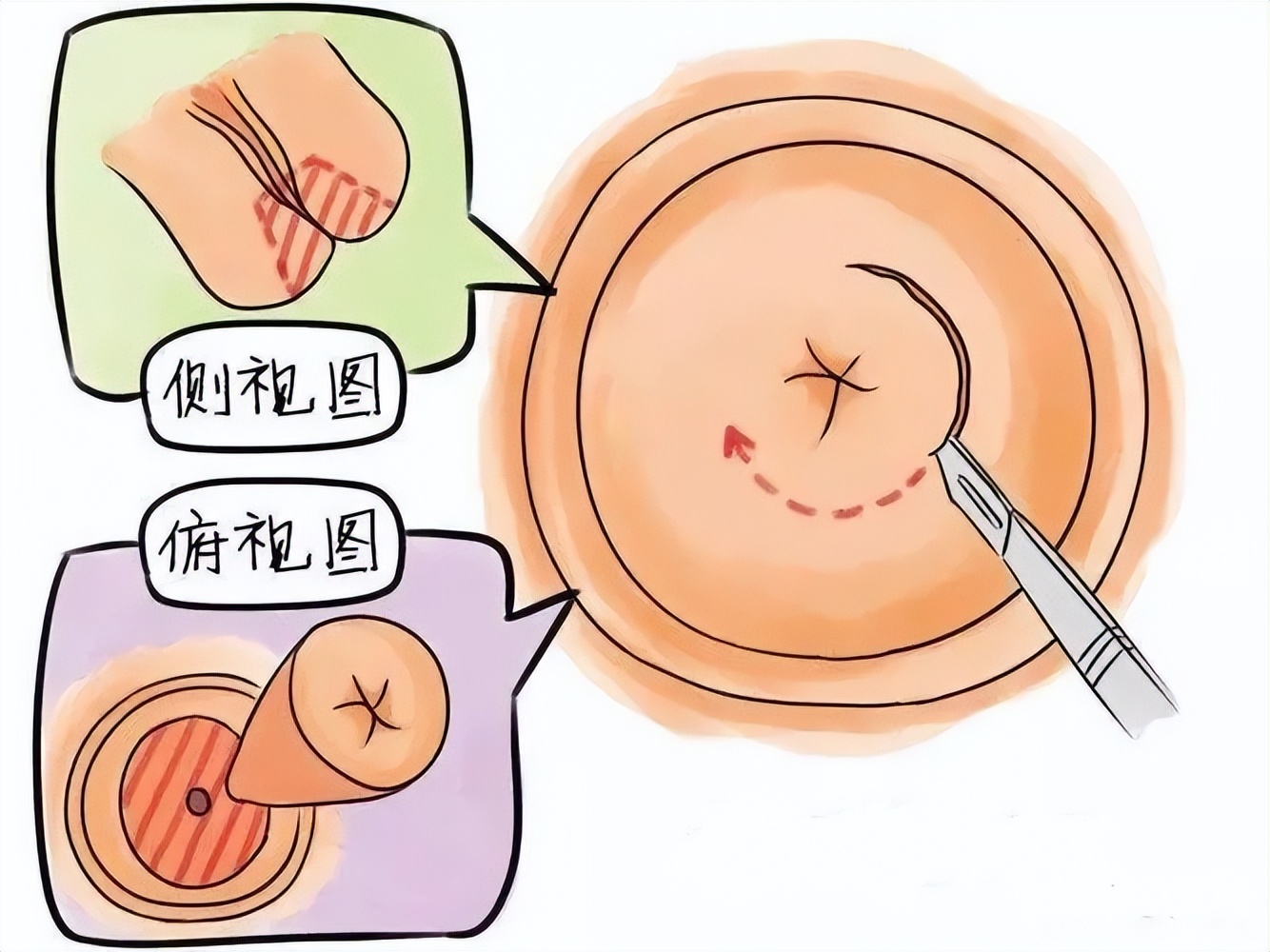 一项让女性“害怕”的妇科检查，它都查些什么？