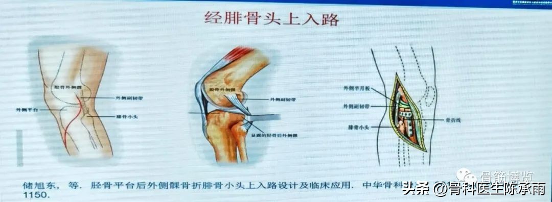 国家卫健委主办的骨创伤专项能力培训项目----下肢损伤学习班