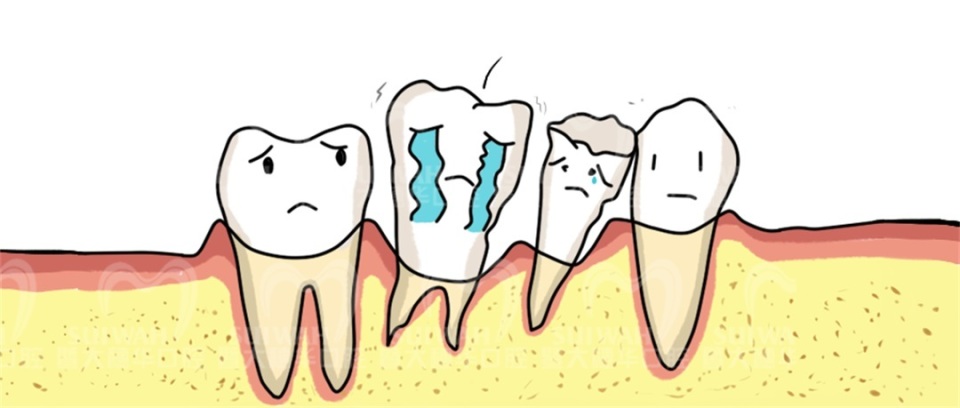 中山大学附属口腔医院牙缝修复,苏州华夏口腔修复牙缝