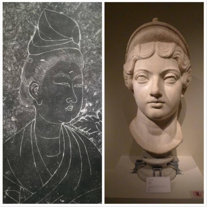 内眦赘皮用手术吗,内眼角内眦赘皮矫正不做手术