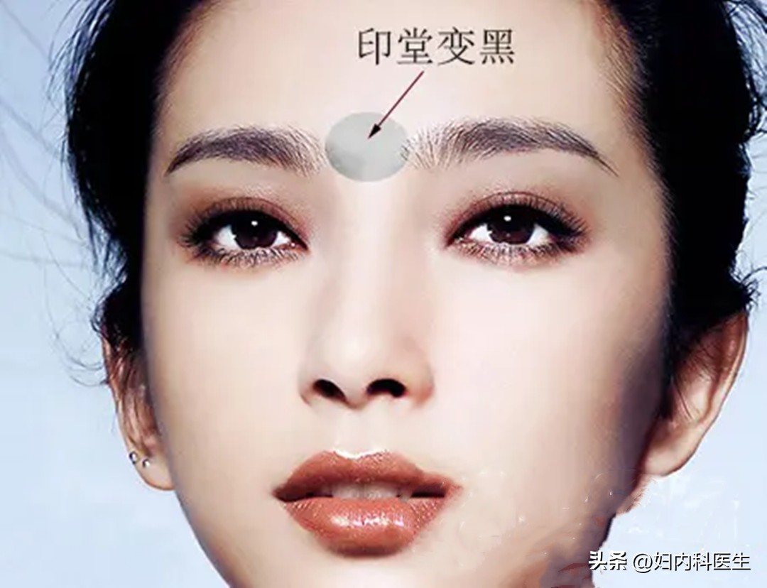 从脸色看出得什么病,面色反映一个人的健康