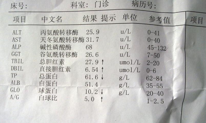 胆红素轻微升高就是丙肝吗,体检发现胆红素偏高是肝受损了