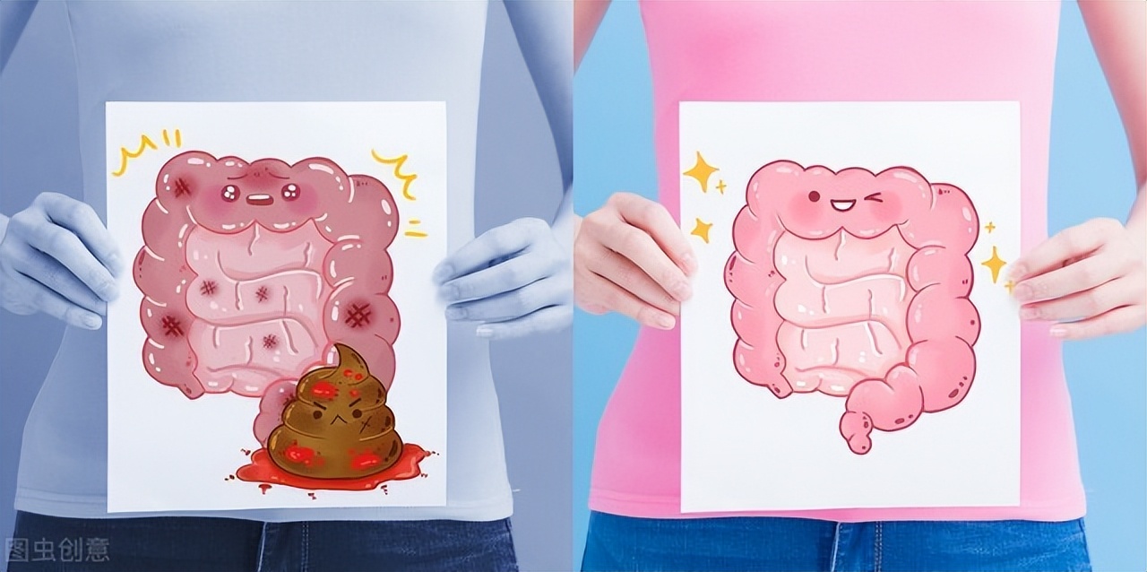 50岁阿姨便血半月，以为是痔疮，一句话引起医生注意，医生：晚了