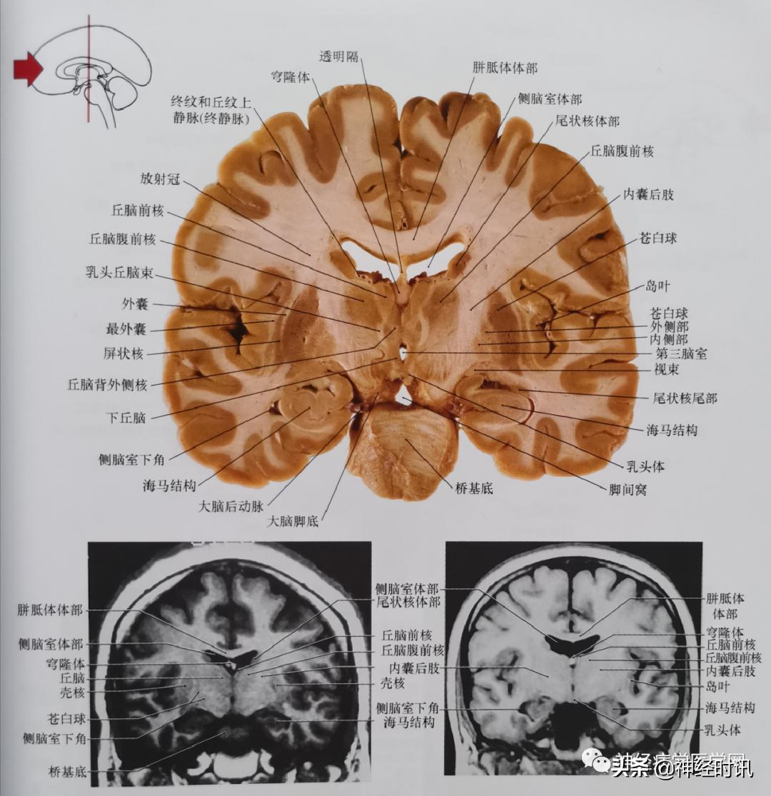 ct袖珍断层解剖图谱最新版,头颅ct断层解剖图谱无水印