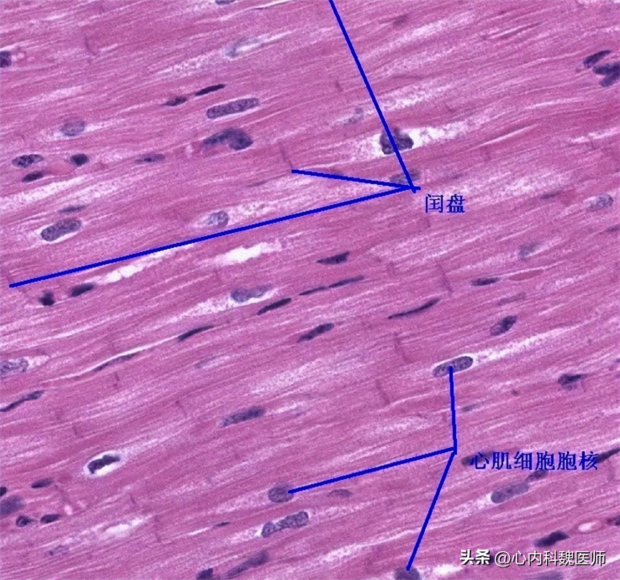 体检窦性心律正常心电图啥意思,体检报告显示窦性心律是什么意思