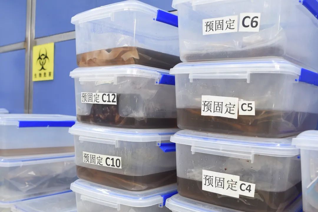 医生说病理报告有点小问题,病理报告没出来好害怕啊