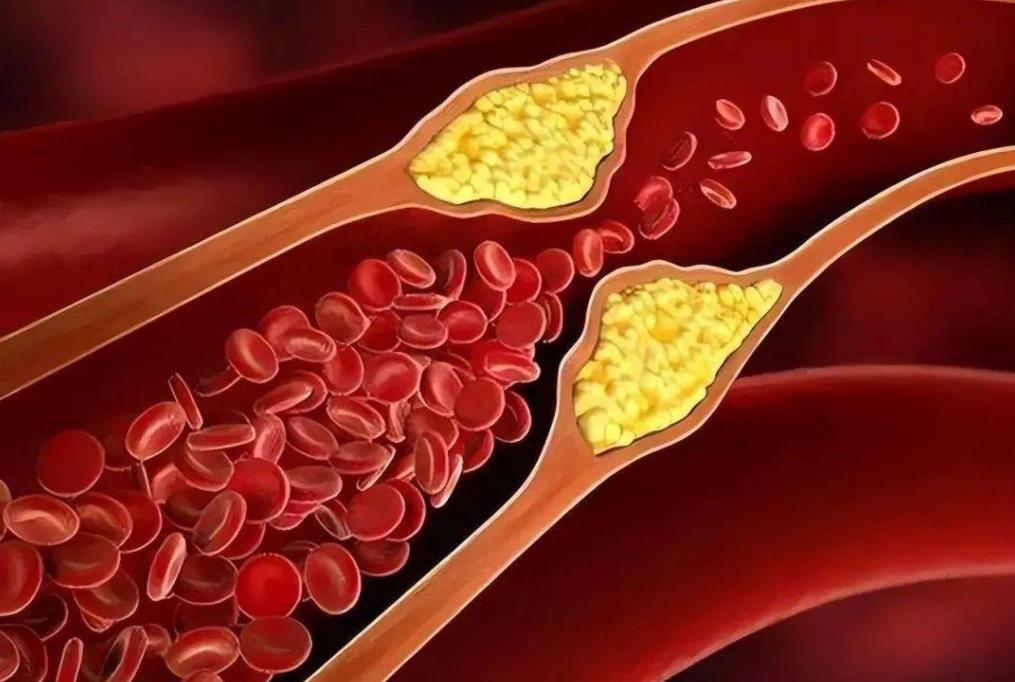 肥胖脖子很黑是不是因为肥胖引起,肥胖人群脖子发黑