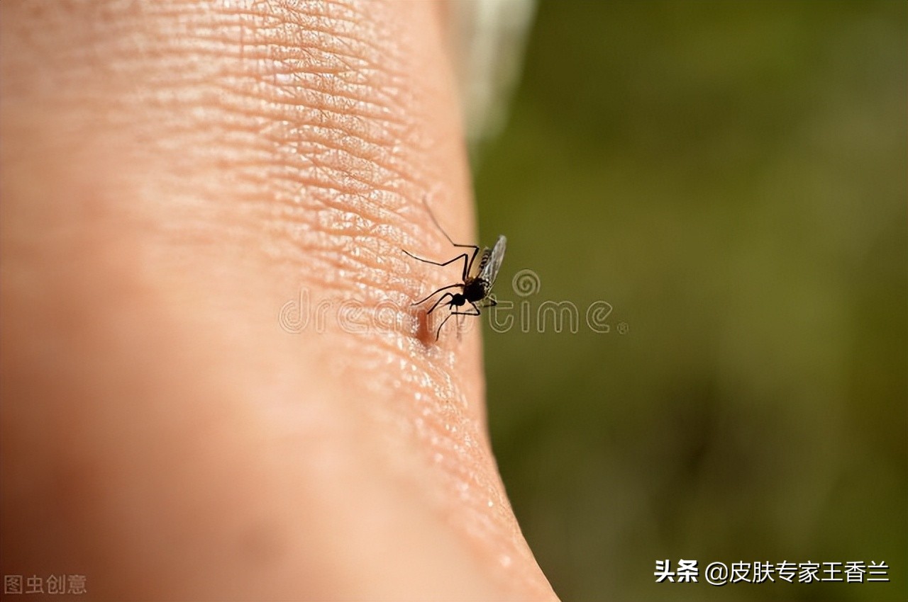 炉甘石洗剂可以用于破损皮肤吗,用完炉甘石洗剂皮肤干燥怎么缓解