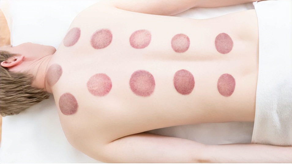 拔火罐益处和弊端,拔火罐有什么好处跟坏处呀