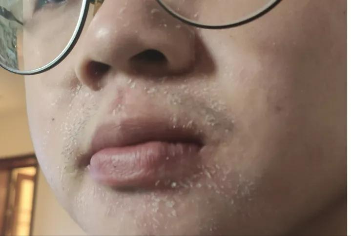 空调房待久了干燥,空调房呆久了皮肤干燥怎么办