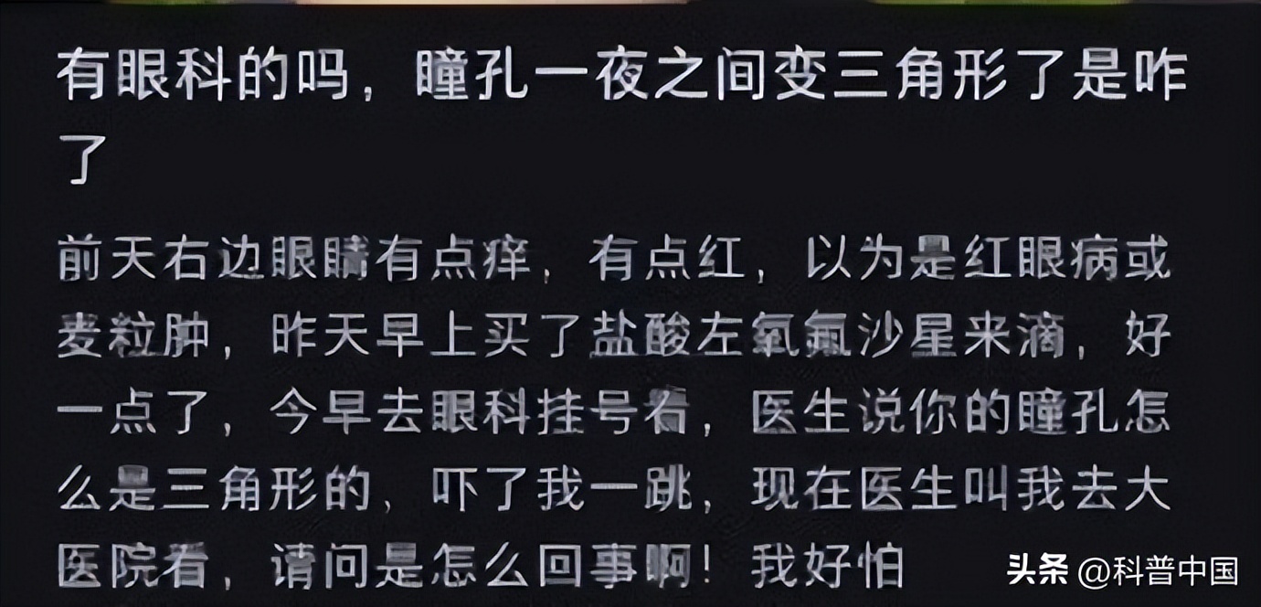 瞳孔三角形后遗症,瞳孔变成三角形是什么原因