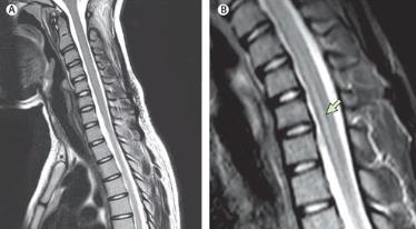 小张正在宿舍与室友们聊天，突然间，一股无力感袭来，...