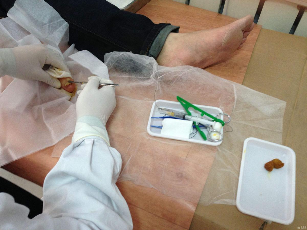 全身麻醉为什么人会失去意识,全身麻醉等于死过一次吗