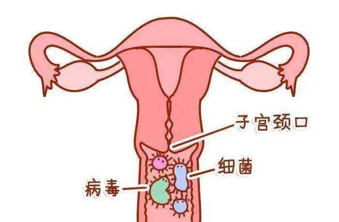 为什么月经结束后有分泌物,月经结束后还有褐色分泌物怎么办