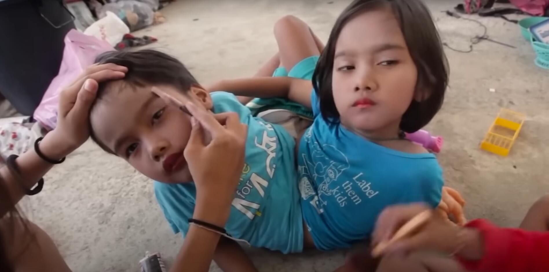 10个难以置信的人类，树皮人、外星人、拥有粗壮手臂的大力水手