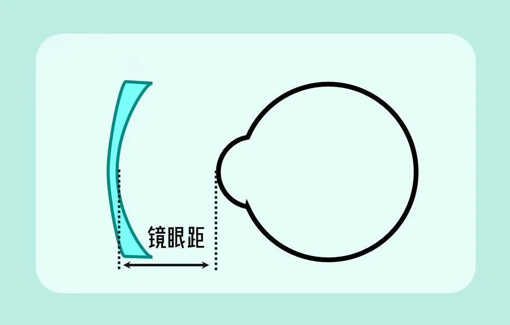 渐进式镜片初次佩戴有哪些不适,刚配的眼镜戴着不舒服可以退吗