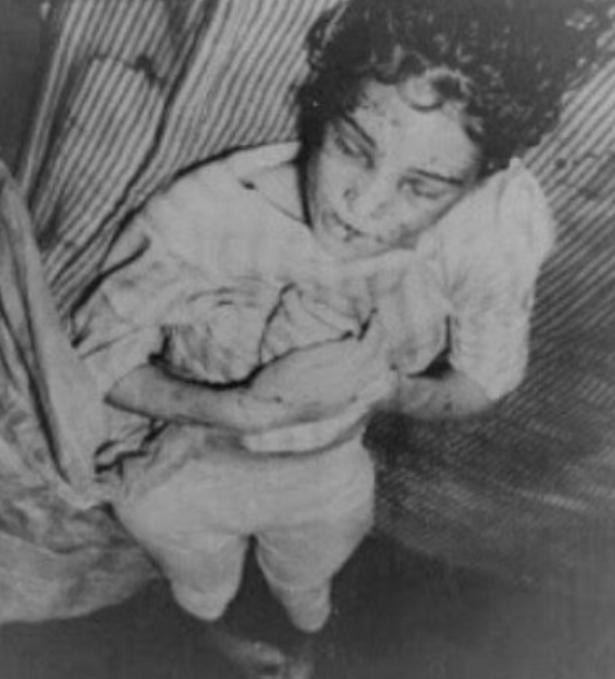 美国最残忍的虐待事件，16岁少女成人形家畜，身上留有150处伤口