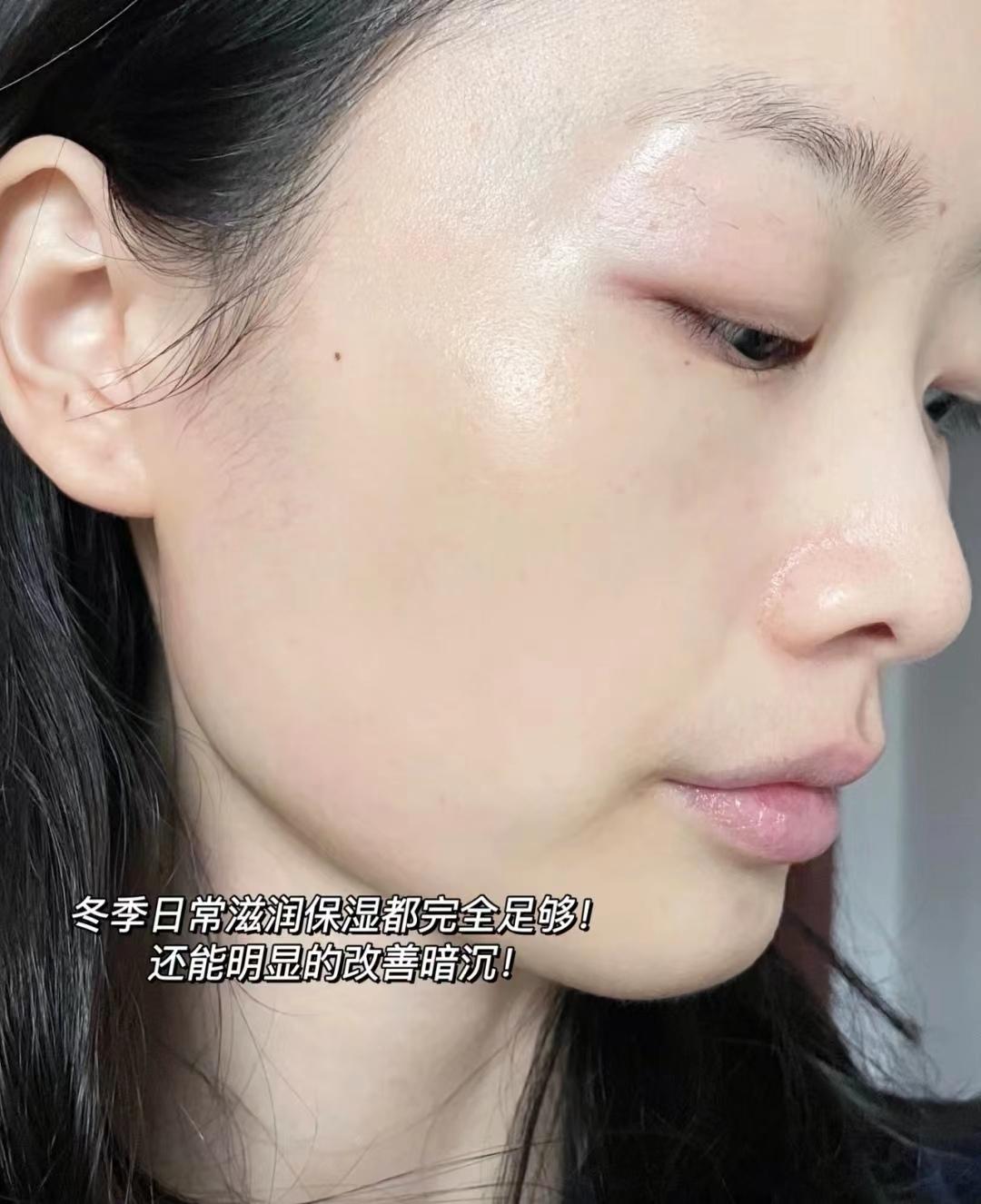 秋冬脸干燥发红用什么面霜,男士秋冬面霜公认好用推荐