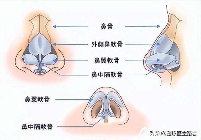 隆鼻恢复后鼻头会往下走吗,隆鼻后鼻头不对称怎么修复