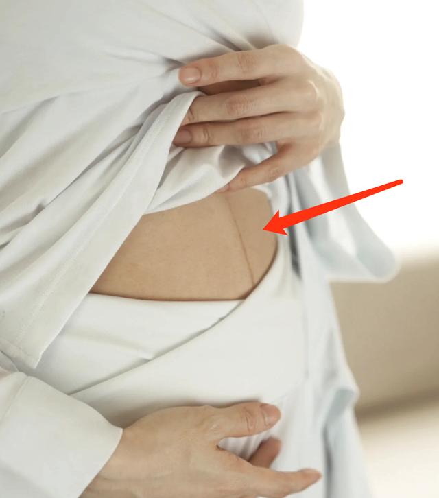 程晓玥直播晒孕肚,程晓玥晒未修妊娠线孕照