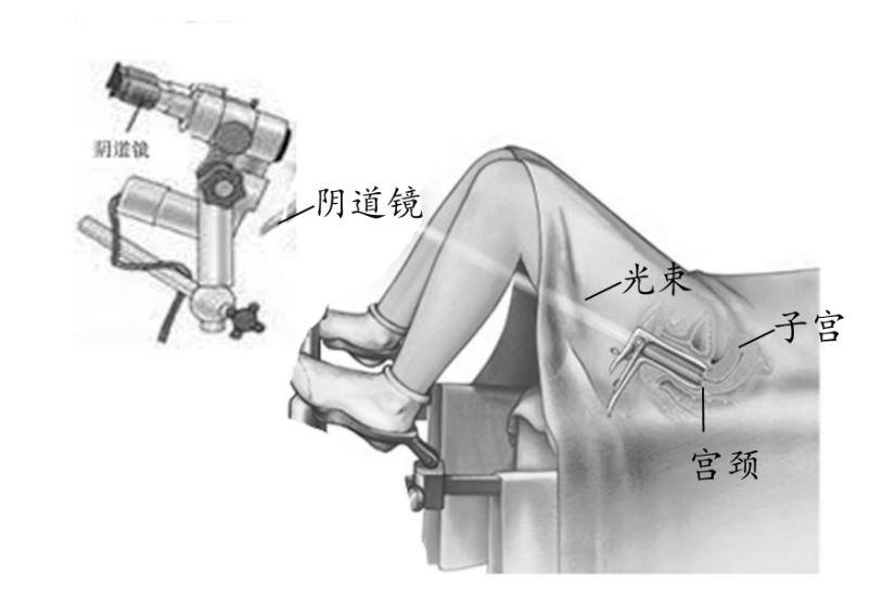 【科普】HPV阳性会变宫颈癌吗？医生用“放大镜”查病变
