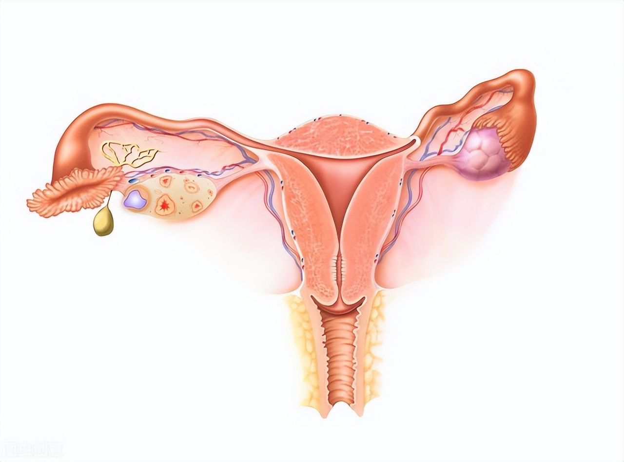 为什么月经期总是疼痛,医生告诉你如何解决它