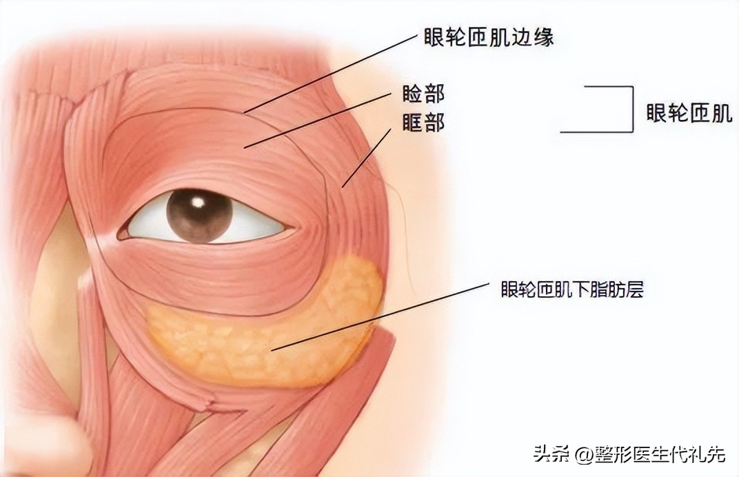 真正的卧蚕和眼袋到底有什么区别,卧蚕和眼袋的区别到底是什么