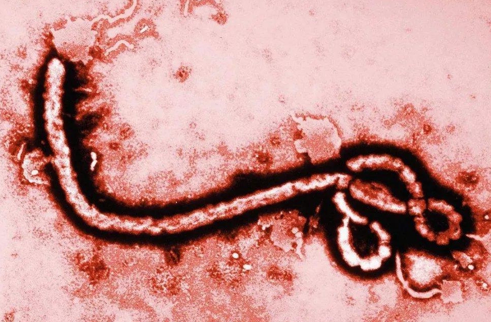 致死率100%！朊病毒烹煮杀不死，无药可救，感染后究竟有多恐怖？