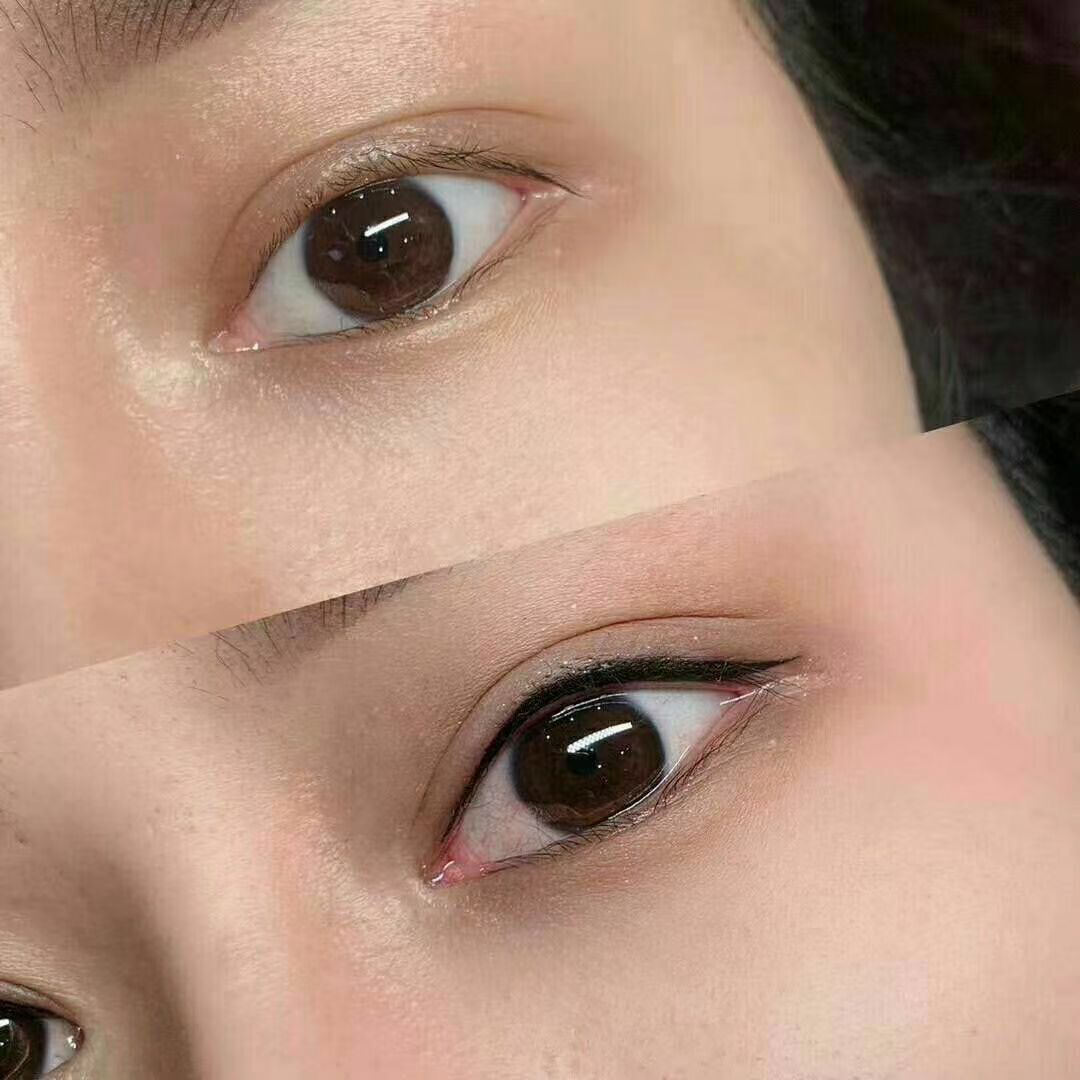 美瞳注意事项和禁忌,美瞳线做完后注意事项