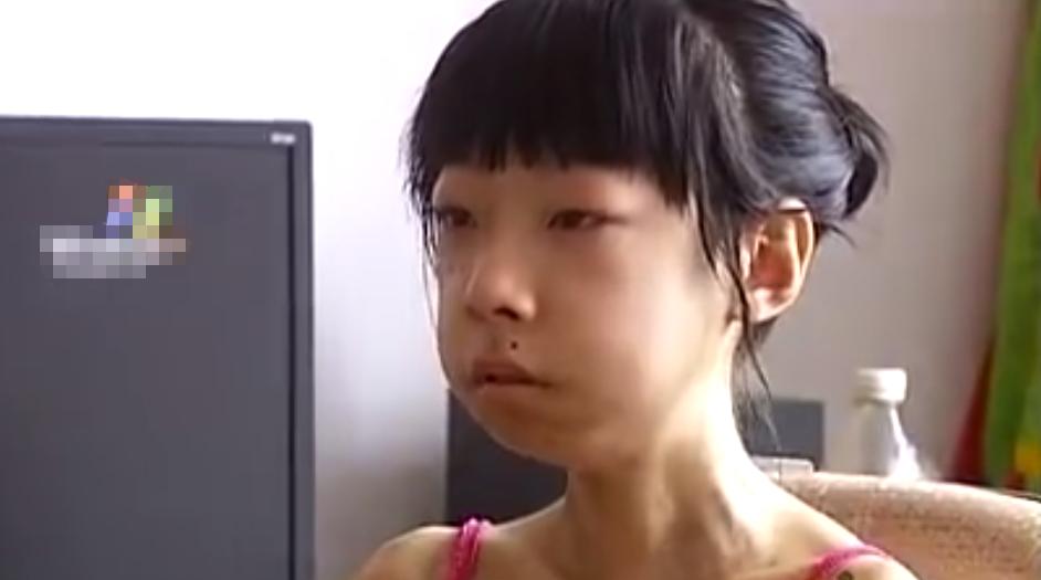 女孩得了怪病的故事,18岁女孩离奇怪病全集