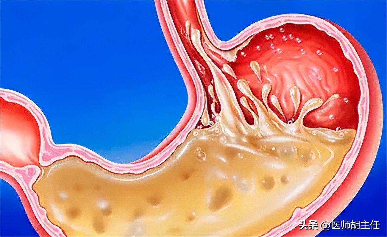 麻醉是最可怕的特别是全麻,全身麻醉等于死过一次吗