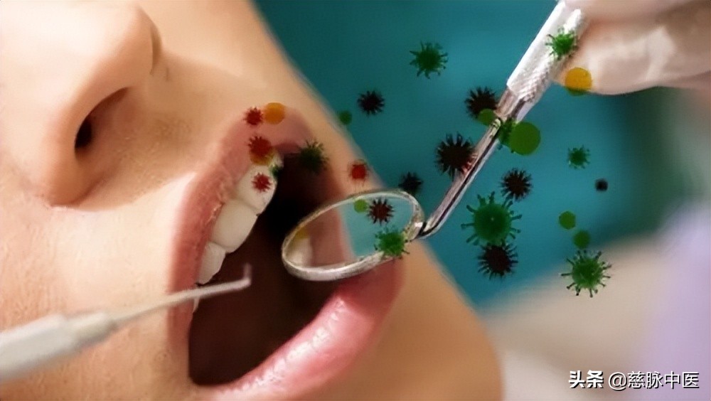 扁平苔藓与口腔溃疡的区别,扁平苔藓口腔溃疡了怎么治疗