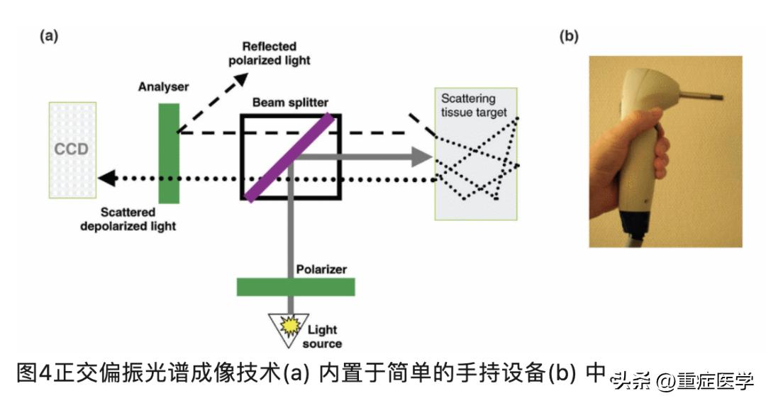 脓毒血症属于哪个系统疾病,脓毒症的快速识别