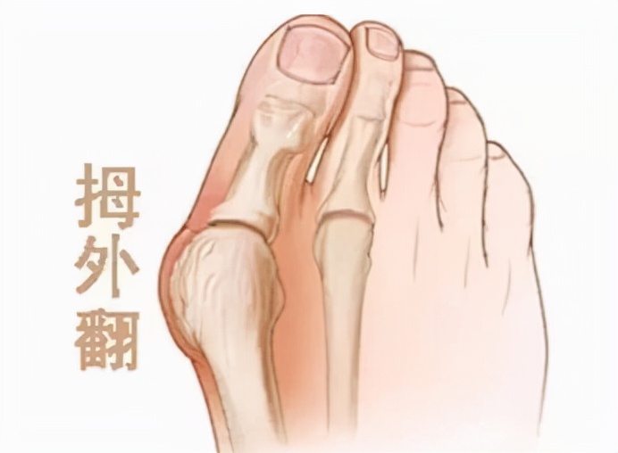 脚底板爱出脚汗怎么回事,脚底板爱紫是什么原因