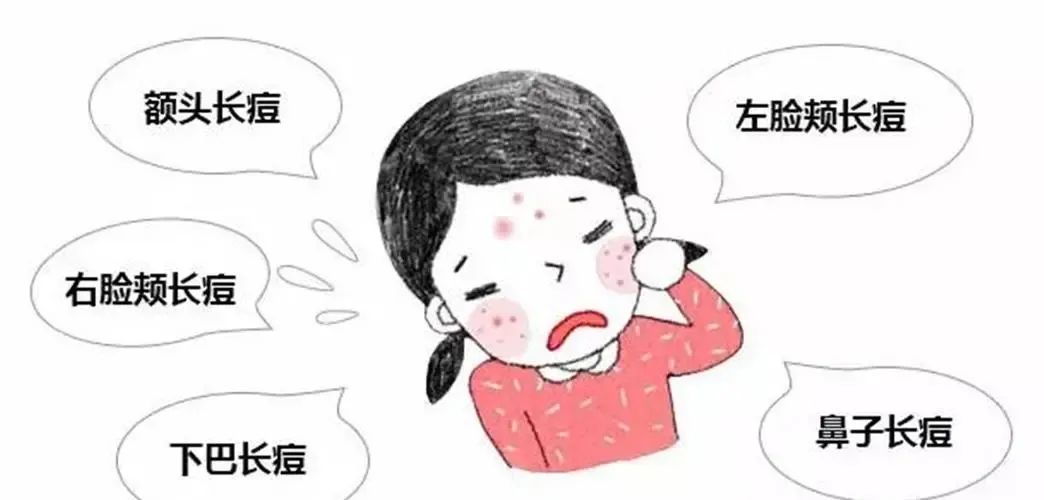 起痘长痘消痘的过程,脸上爆痘千万不要急