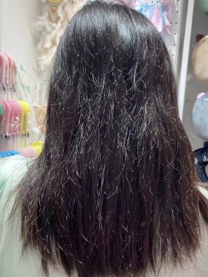 哪些因素会导致秃发,怎样可以停止斑秃继续掉发