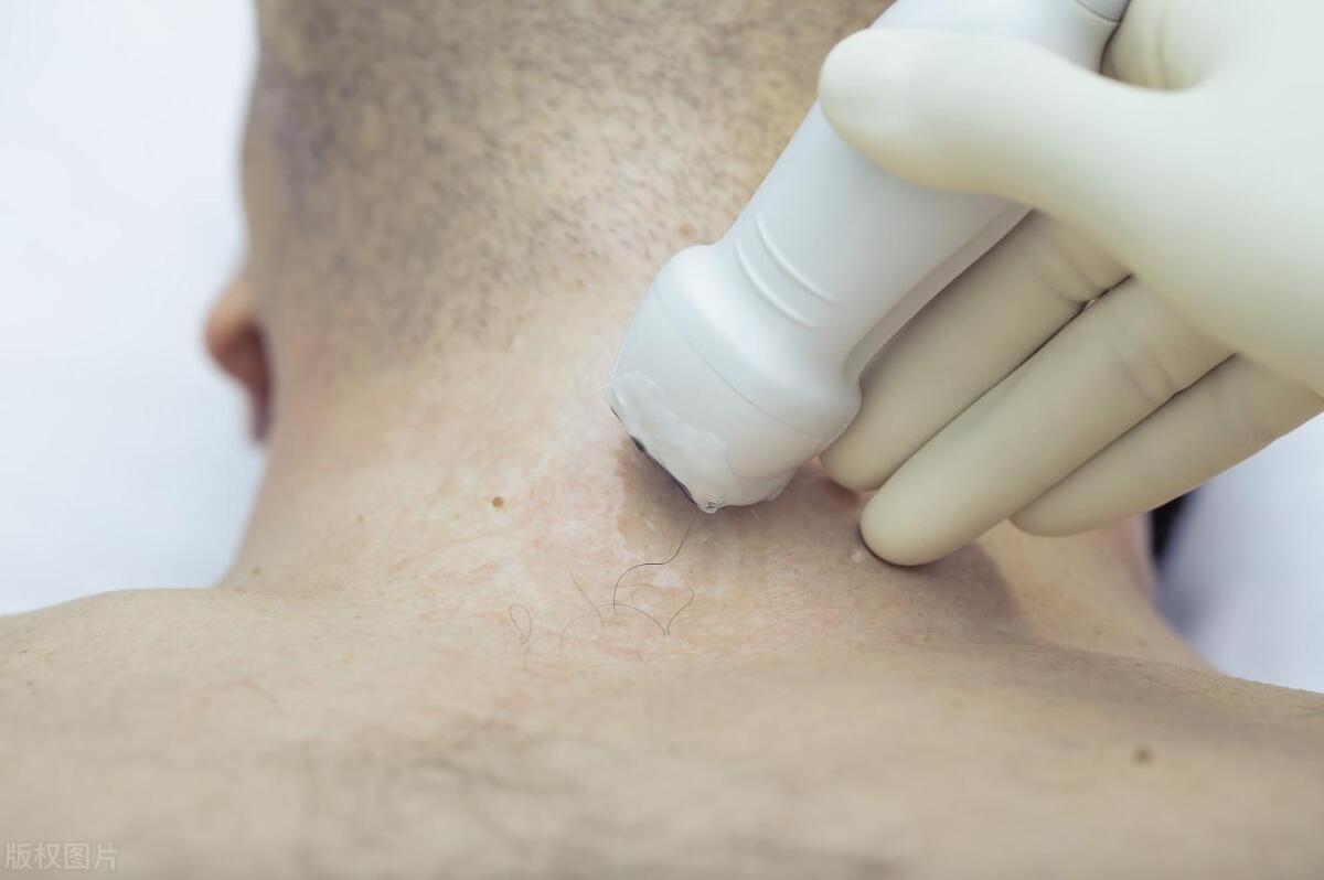 颈动脉斑块6.1x1.8mm要吃药吗,颈动脉斑块7.9x1.9mm需要吃药吗