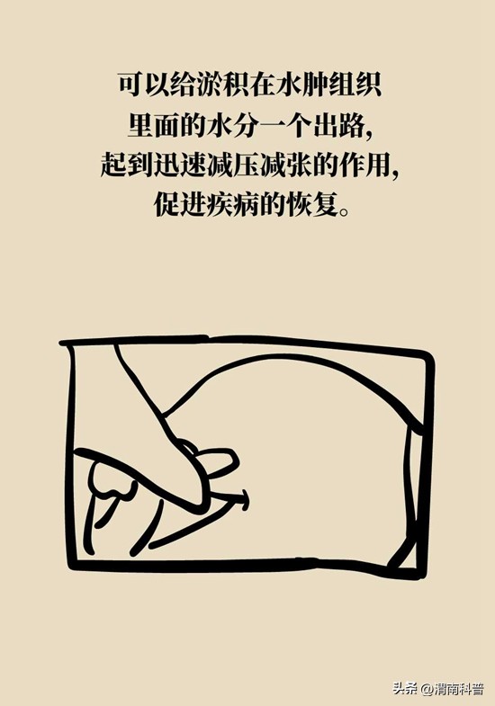 肩膀不抻不疼一抻就疼,肩膀往后伸疼