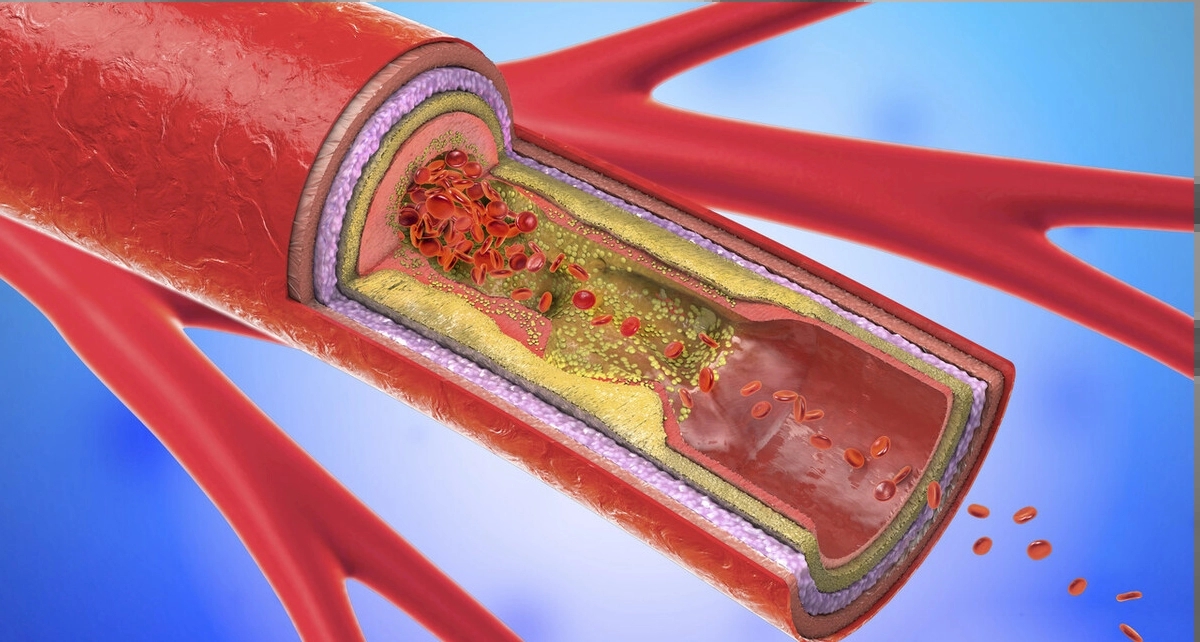 晚餐与体重和寿命的关系,晚餐决定你的体重和寿命