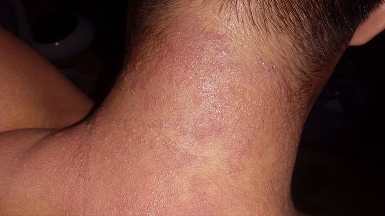 十大疼痛疾病排行榜,四种最疼痛病是什么