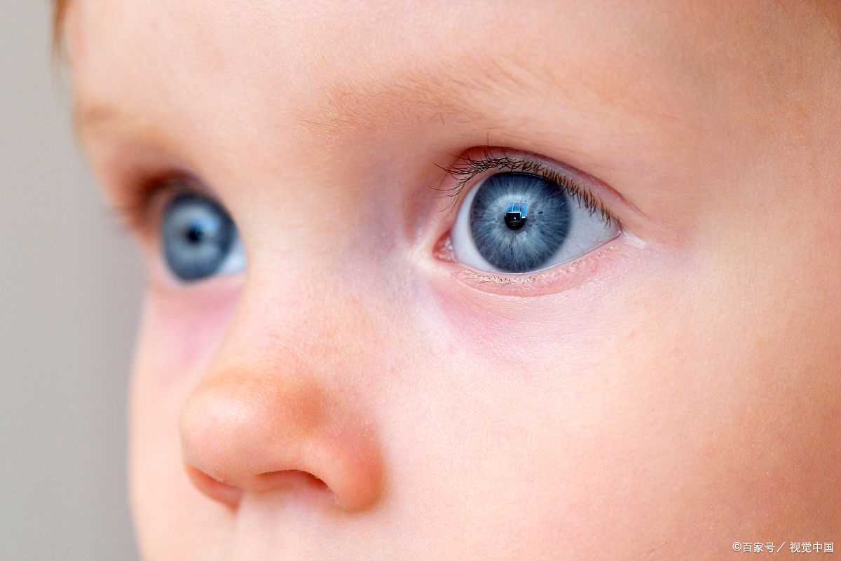 小孩突然眼屎多是什么原因引起的,三岁宝宝眼屎多眼睛肿是什么原因