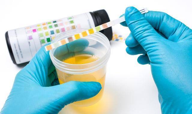 糖尿病尿是什么意思,糖尿病是晚上尿多还是白天尿多