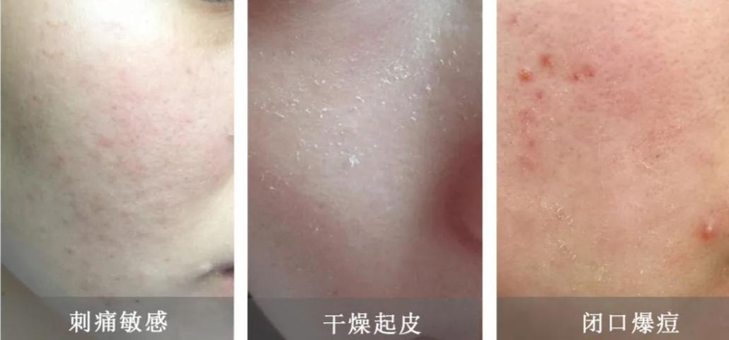 兰蔻菁纯眼精华秒杀,兰蔻菁纯臻颜玫瑰精萃水150ml价格