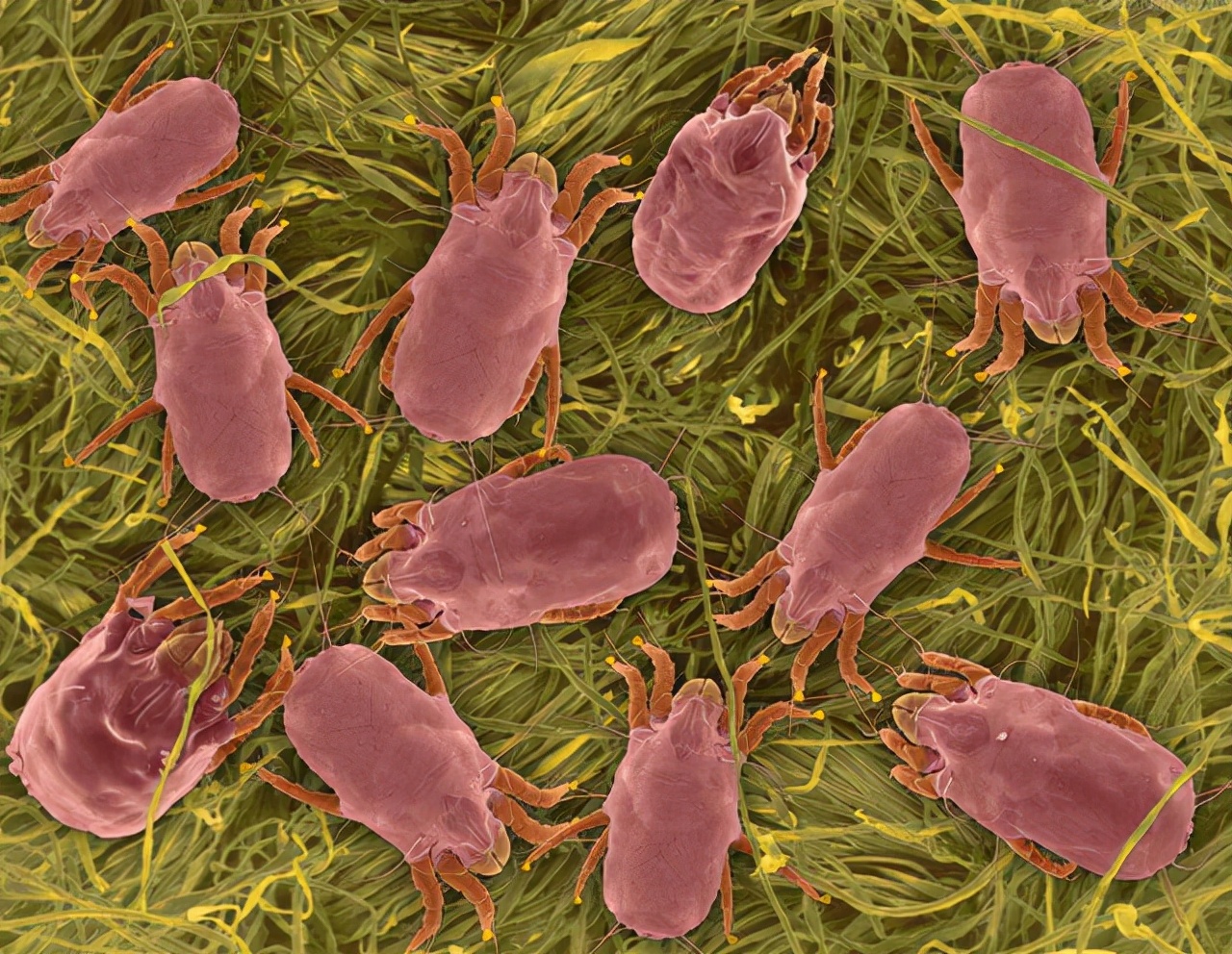 鼻子上挤出来的白色絮状是什么,鼻子挤压出现的白色条状物