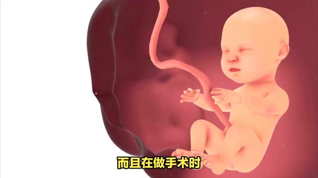 意外怀孕哪个时间段做人流最合适,石狮医院做人流多少钱