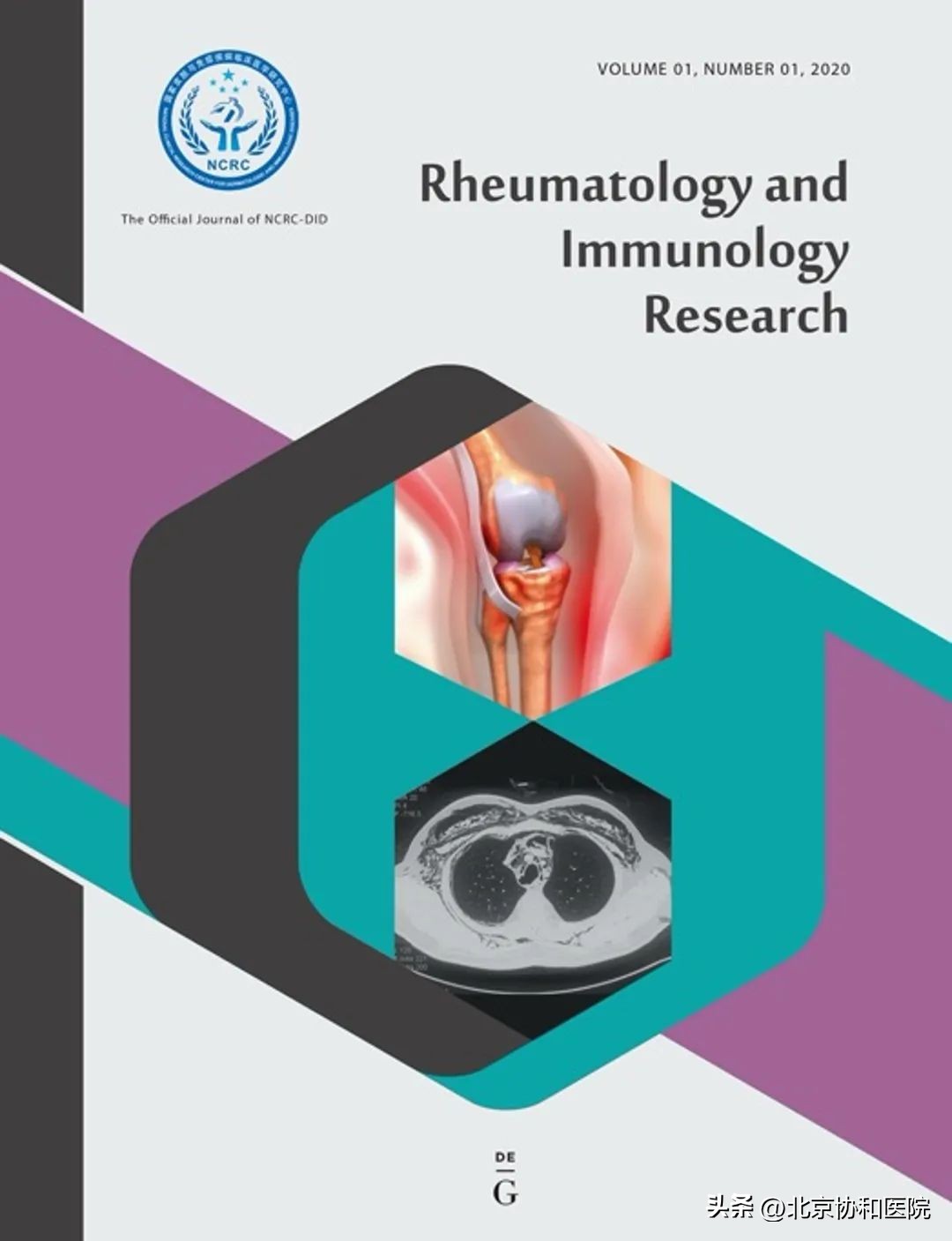 风湿免疫科护理健康科普大赛作品,风湿免疫科发展规划