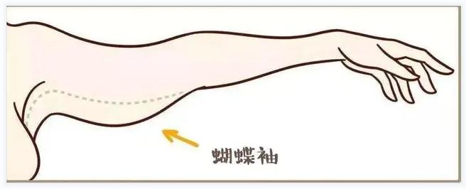 吸脂瘦手臂的效果怎么样呢,吸脂瘦手臂有什么危害吗