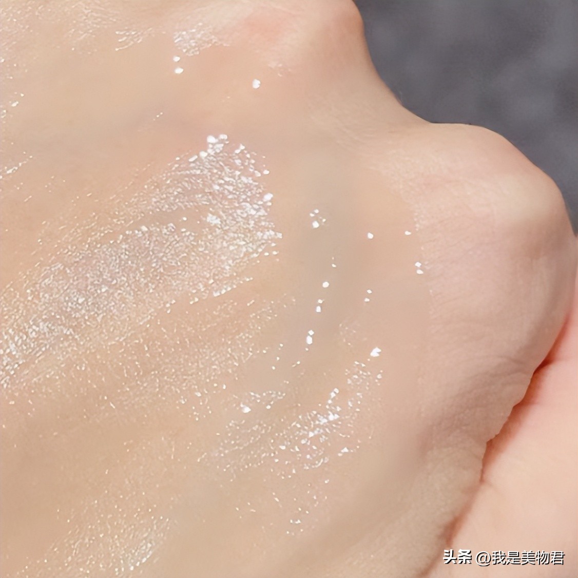 太阳把皮肤晒坏了怎么修复,晒后皮肤痒如何修复