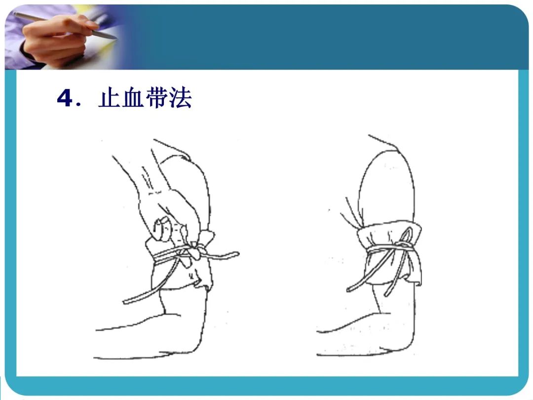 创伤后应激障碍ppt课件,创伤ppt课件